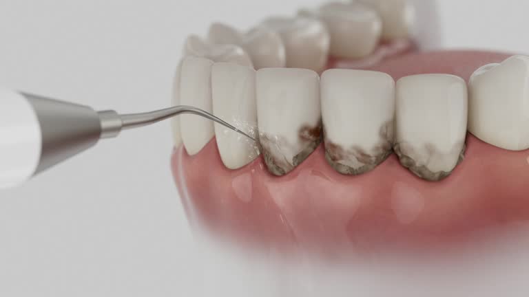Trusted Wisdom Tooth Removal service in Bandon, OR - Dentist Open Now